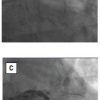 Figure 54